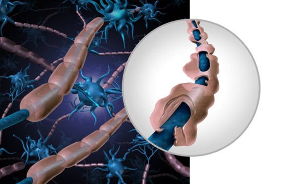 วิตามินบี 12 ทำหน้าที่ปกป้องเกราะปลอกไมอีลิน (myelin sheath)